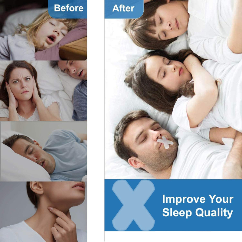 Sleep Strips, Anti Snoring Devices Advanced Gentle Mouth Tape For ...